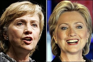Hillary vorher und nachher
