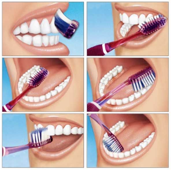 cómo cepillarse los dientes