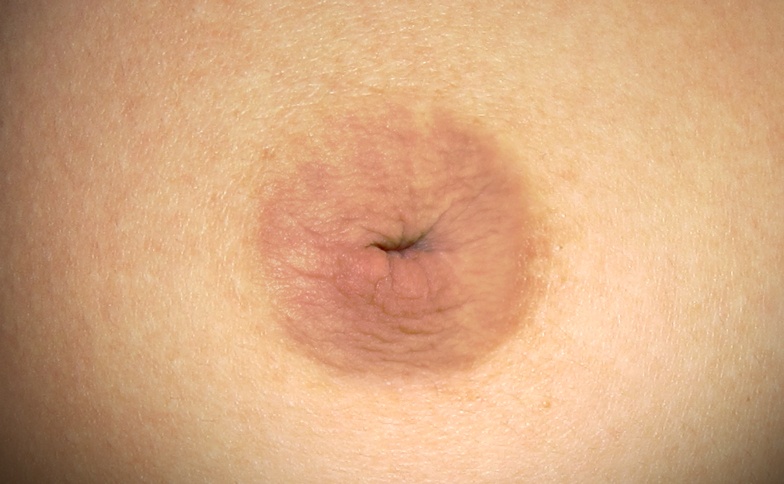 chirurgie-correction-mamelons-inverses