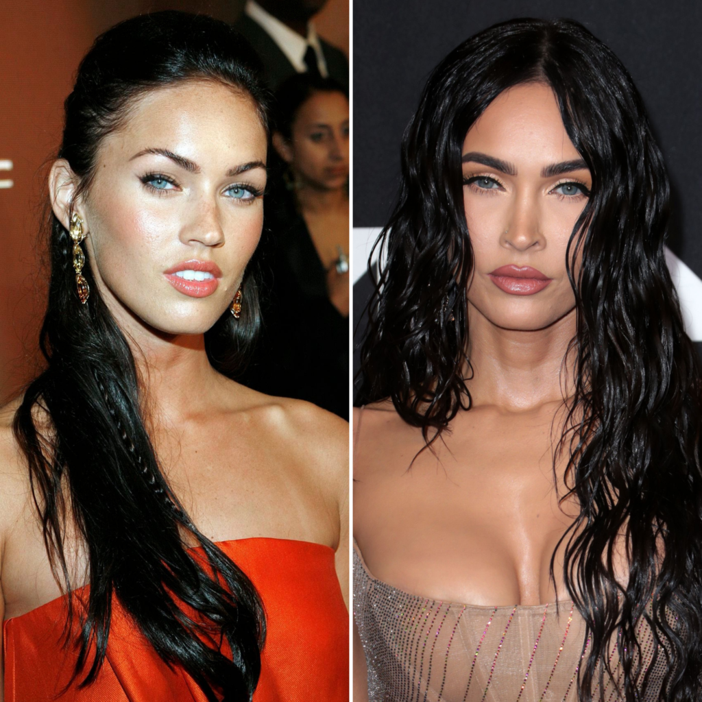 Megan-Fox-avant-apres-chirurgie-esthetique