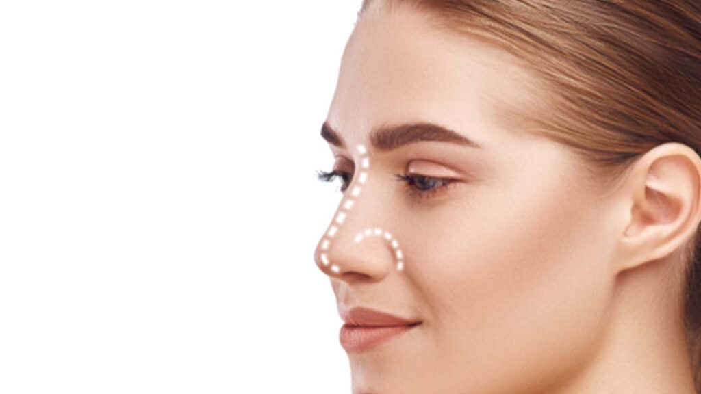 prix-rhinoplastie-quebec